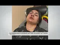Woman recovering after violent attack in Daly City