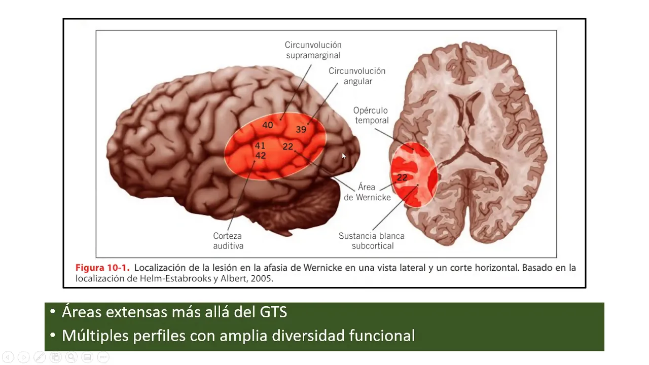 Neuropsicología de las Afasias 2