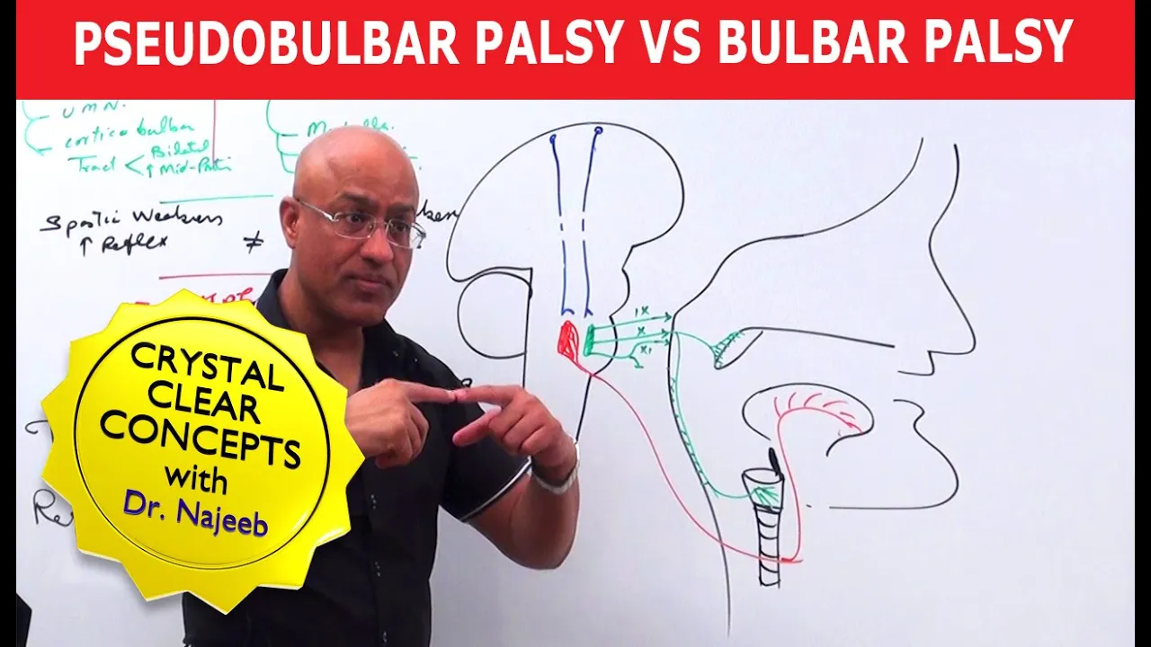 Pseudobulbar Palsy vs Bulbar Palsy