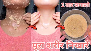 Best Remedy For fairer Body|बेसन/नींबू से मै अपने Body मे जमी मैल,गंदगी,कालापन मिनटो मे साफ करती हूँ