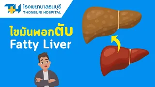 ควรหลีกเลี่ยงอาหารประเภทใดเมื่อมีไขมันพอกตับ