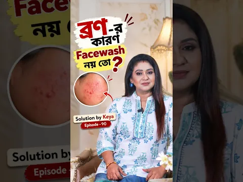 ব্রণ-র কারণ Facewash নয় তো? 🤔 | Acne Causes & Skincare Tips |