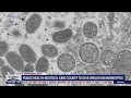 Public Health-Seattle King County to give update on monkeypox FOX 13 Seattle