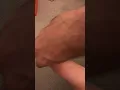 Great toe passive range of motion