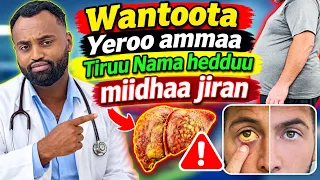 Tiruukee wantoota utuu ati hin beekin dadhabsiisaa jiran | Cooma Tiruu |