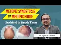 Lagu What is the difference between Metopic Synostosis and Metopic Ridge? - Dr. Vybhav Deraje