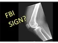 How to Master Knee X-Rays