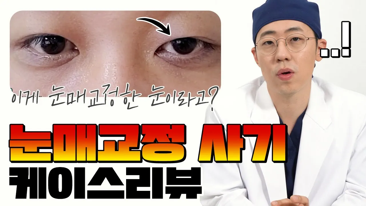 눈매교정 사기😱 왜 한다고 해놓고 안했어요 ㅠ #눈매교정 #눈재수술 #쌍꺼풀