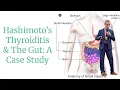 Hashimoto s Thyroiditis The Gut A Case Study from Dr Joe Mather MD MPH TM