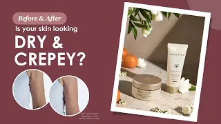 Rejuvenate Dry and Crepey Skin with Crepe Erase