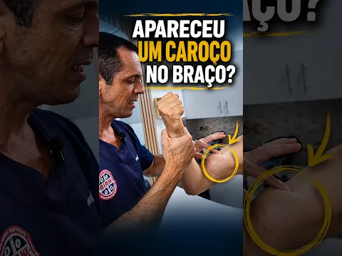 Apareceu um caroço no braço? Sinal de Popeye