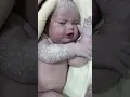Download Lagu Pure Love 💖 | Beautiful Chubby Newborn Baby with Down Syndrome Moments After Birth