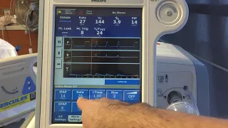 Non-Invasive Ventilation NIV - Basics