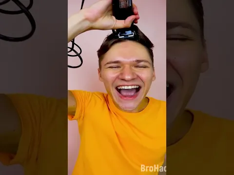 I'm bald now