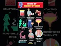 Download Lagu 9 Signs of Kidney Stones You Shouldn’t Ignore | How to Know If You Have Kidney Stones