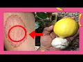 HOW TO GET RID OF RINGWORM AT HOME WITH TO TREAT