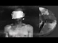 Download Lagu The Vomit Arsonist - Can't See