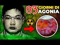 Living in a DECEASED Body for 83 Days WORST DEATH EVER