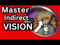 Master Indirect Vision - One of the Hardest Beginner Dental Skills