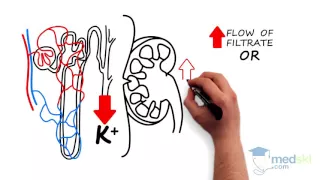 Internal Medicine - Hypokalemia By Steven Cheng M D