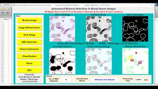 Matlab Code For Malaria Detection In Blood Smear Images Using Image Processing IEEE Based Project