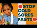 SECRET to Getting Rid of Cold Sores in 3 Days or less - Luminance Red Exposed