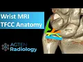 Download Lagu MRI Anatomy of TFCC