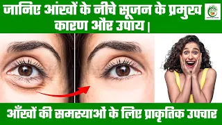 Powerful Tips | Say Goodbye to Under Eye Swelling with These Tips | eye bags solution