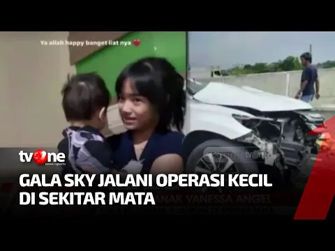 Anak Mendiang Vanessa-Bibi Jalani Operasi Kecil