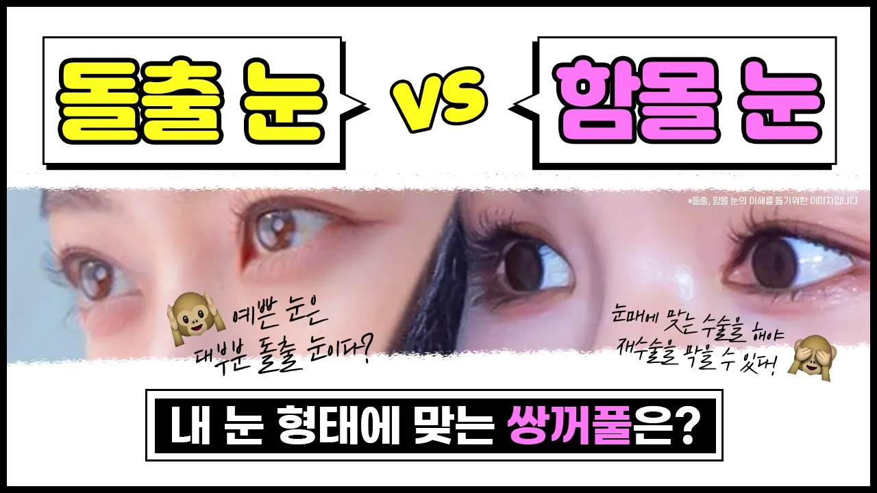 [눈성형]돌출 눈, 함몰 눈👀 눈 형태에 따라 추천하는 수술이 달라집니다! 돌출눈과 함몰눈에 대한 오해까지 풀어드릴게요🙆