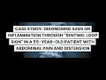 CASE STUDY DIAGNOSING ILEUS OR INFLAMMATION THROUGH SENTINEL LOOP SIGN