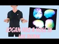 Logan Paul damaged his brain badly