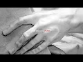 The National  - About Today  (Live in Rome)