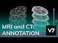 MRI and CT Image Annotation - V7 AI Academy