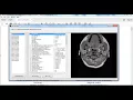 matlab based mini projects matlab based mini thesis matlab based mini projects code