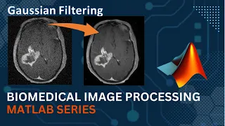 Gaussian Filter MATLAB Code Implementation Medical Image Processing Computer Vision