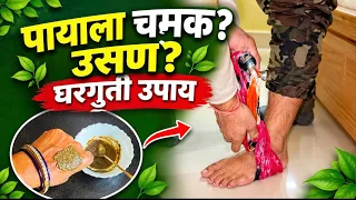 पायाला चमक भरणे, उसण भरणे? 😣 करा हा खास घरगुती उपाय! 🌿 लगेच आराम मिळवण्यासाठी Gharguti upay ✨👍