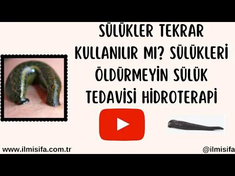 Download MP3 Sülükler Tekrar Kullanılır mı? Sülükleri Öldürmeyin Sülük Tedavisi Hidroterapi