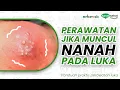 Download Lagu Perawatan Jika Muncul Nanah Pada Luka | Kanal Sehat Metcovazin