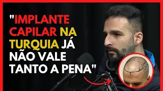 O QUE NINGUÉM TE CONTA SOBRE IMPLANTE CAPILAR NA TURQUIA - CARRO CHEFE - FULLPOWER TV