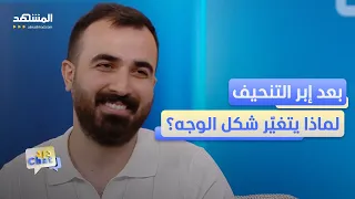 "وجه المونجارو".. ترند جديد يفتح أبواب عيادات التجميل - دردشات