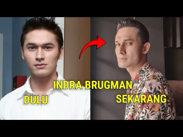 Download MP3 Kondisi Terkini Indra Brugman Sangat mengenaskan