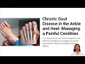 What Is Chronic Gout Disease in the Ankle and Heel ICD-10 Definition and Meaning
