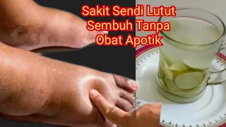 CUKUP 1 GELAS 2 KALI SEHARI!! SAKIT LUTUT SENDI SEMBUT TANPA ONAT APOTIK!!