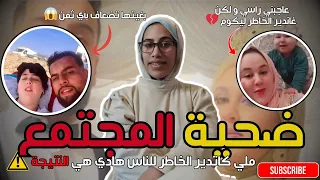 سلمى تيبو شكون كان السبب التنمر ولا العملية الوجه الخفي لعمليات التجميل و أسرار حصرية 