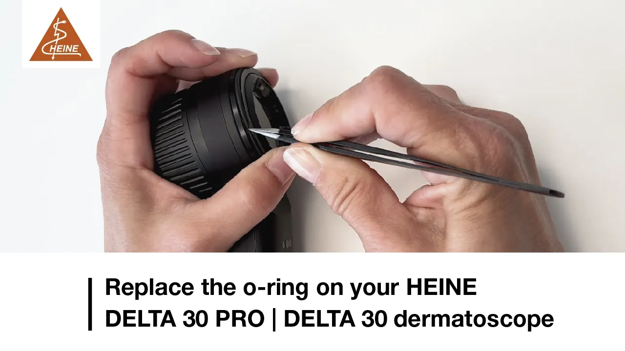 How to exchange the o-ring on the HEINE DELTA 30 PRO or DELTA 30 dermatoscope