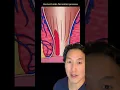 Download Lagu What is a Hemorrhoid and How Do You Treat It? #shorts #hemorrhoids