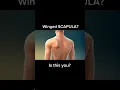 Download Lagu How to Fix Scapular Winging - Quick #calisthenics