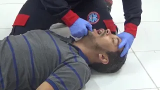 Aula nº 06   Obstrução de Vias Aéreas por Corpo Estranho OVACE