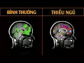 Download Lagu Điều Gì Xảy Ra Với Bộ Não Khi Bạn Thiếu Ngủ?